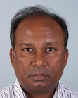 Before Hair Transplant &nbsp;Front